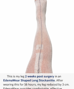 EdemaWear