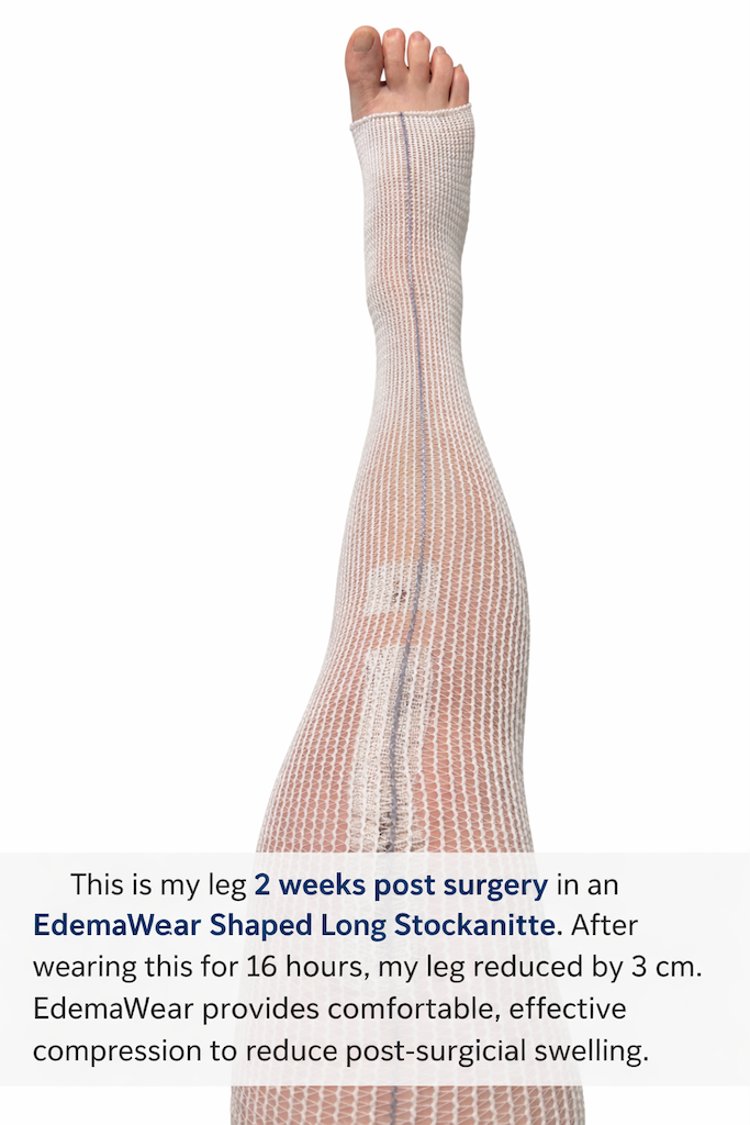 EdemaWear